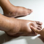 diabetic foot assessment at heal and soul health podiatrist geelong